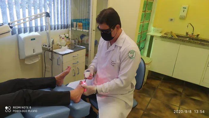 Tratamento com Laser em micose de unha