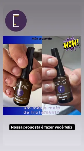 Base Fortalecedora de Unha 