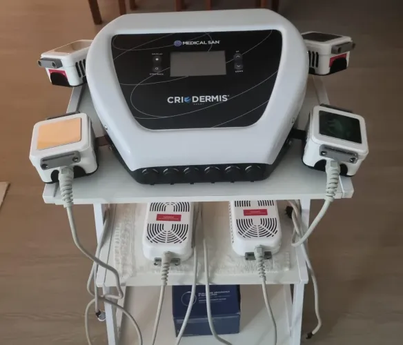 Criolipólise de Placas