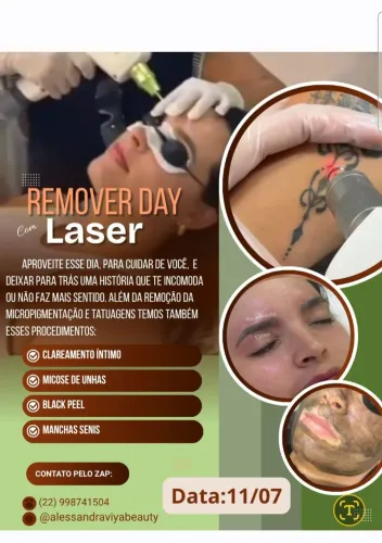  Remover Day - RS189,00
