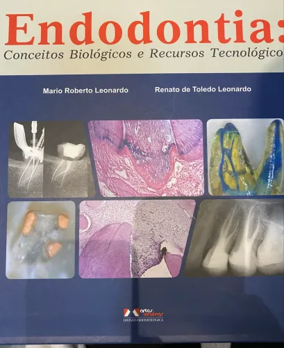Livro endodontia conceitos biológicos e recursos tecnológicos