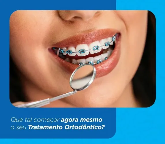 RESTAM APENAS 7 VAGAS 