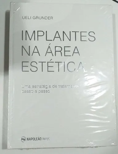 Implantes Na Área Estética - Livro de Odontologia 
