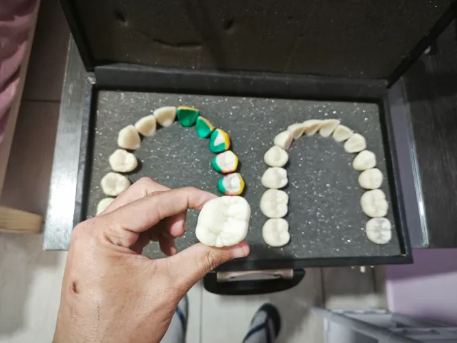 Kit de Dentes Anatômicos para Prótese Dentária + Maleta | Odontologia