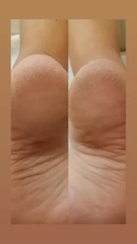 Modelo várias áreas 
