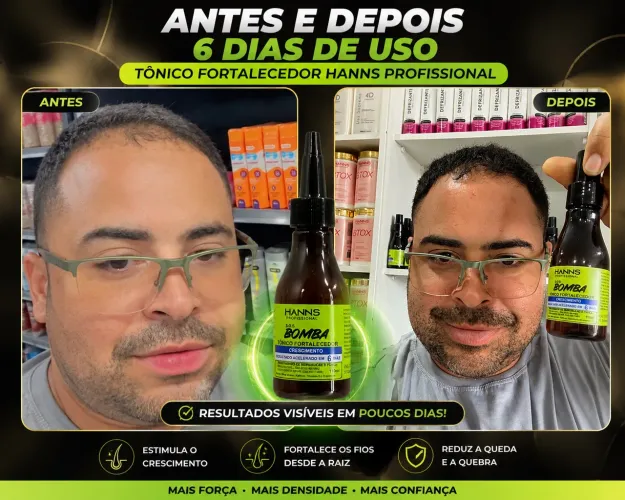 Tonico poderoso SOS crescimento em 6 dias