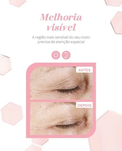 Cuide da sua área dos olhos com MARY KAY