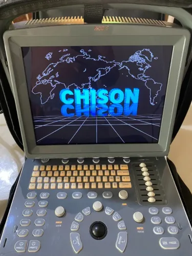 Ultrassom CHISON ECO 1 com Probe Linear - Portátil - Excelente Estado