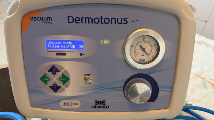 Equipamento Estético de Vacuoterapia