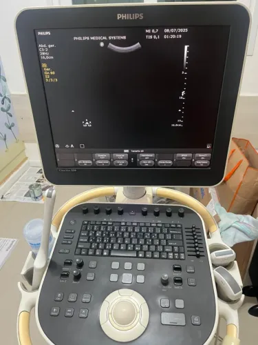 Aparelho de Ultrassom Philips ClearVue 550