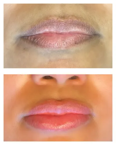 Micropigmentação labial