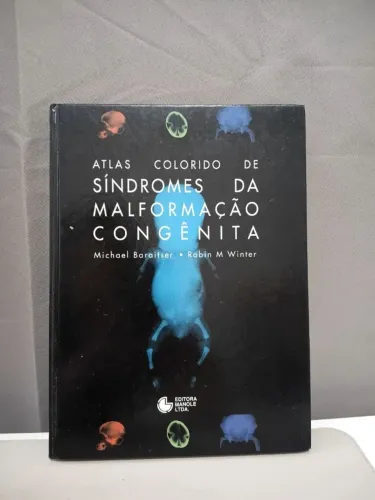 Atlas Colorido de Síndromes da Malformação Congênita - Manole
