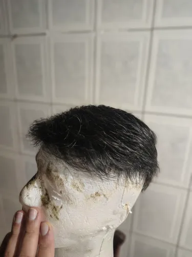 Prótese Capilar