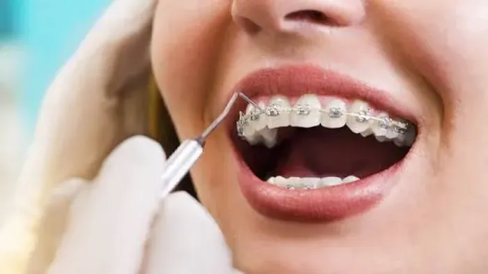 Parceria dentista ortodontista