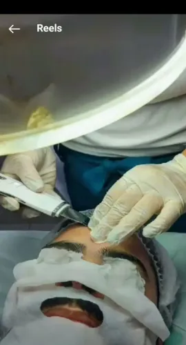 Limpeza de Pele 35+
