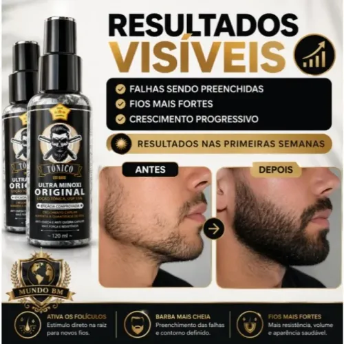 Oferta Relâmpago! Kit 2 Tônicos Capilares UltraDlust 15% | Original