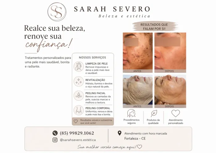 Estética