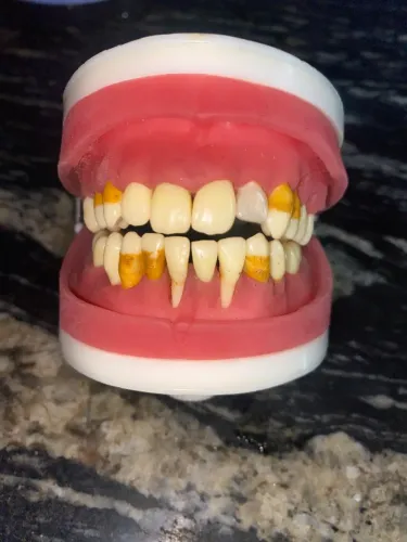 MANEQUIM ARTICULADO DE CIRURGIA COM DENTES DE PERIODONTIA