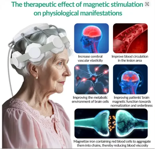 Estimulador Magnético Transcraniano - RTMS