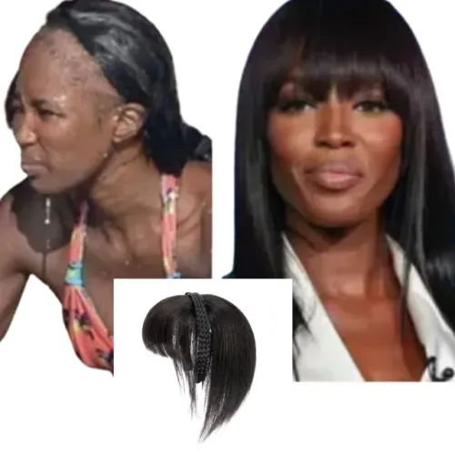 Franjas tiara pra calvíce feminina 