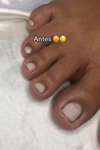 ESMALTAÇÃO EM GEL PARA PÉS DECORADA