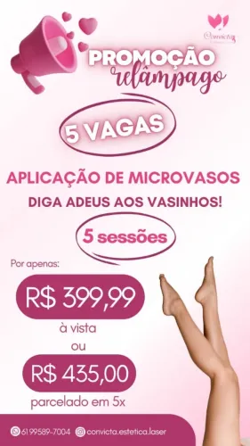 Tratamento Microvasos e Varizes