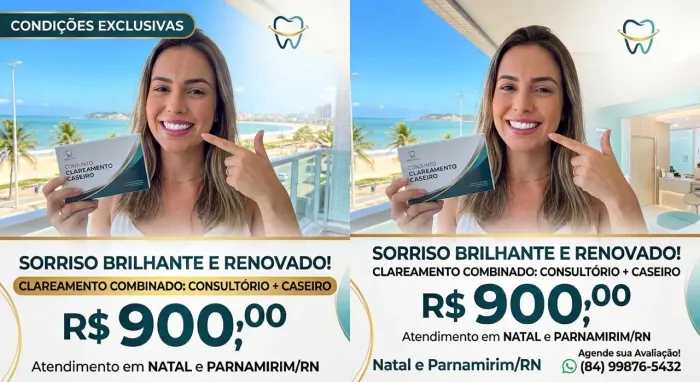 Clareamento dental