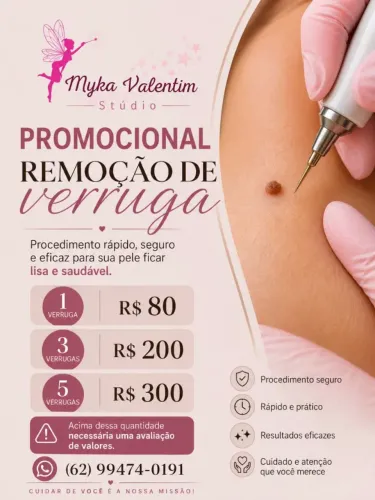 Remoção de Verruga