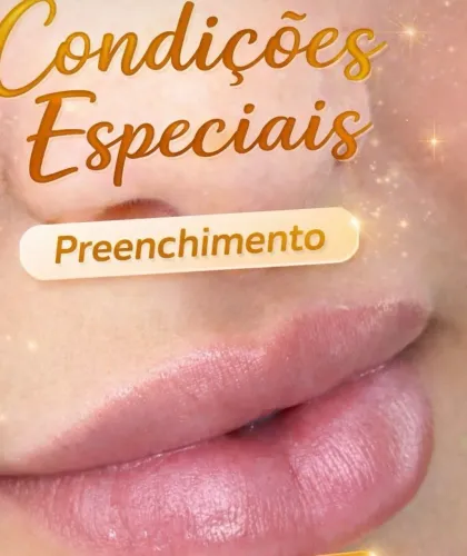 Curso preenchimento facial e lábio