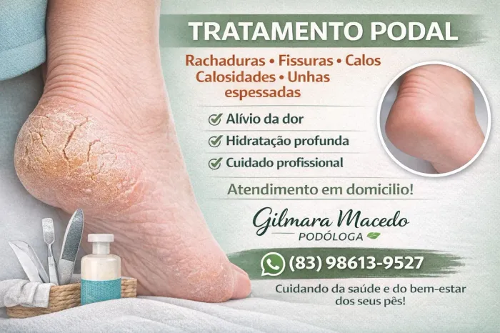 Cuidado com pés!