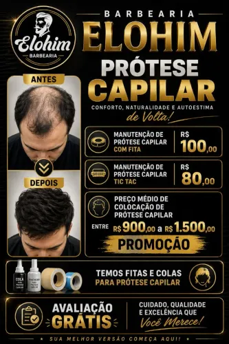 prótese capilar '