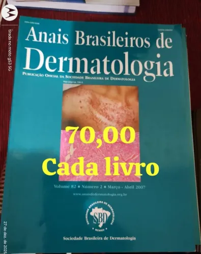 Livros