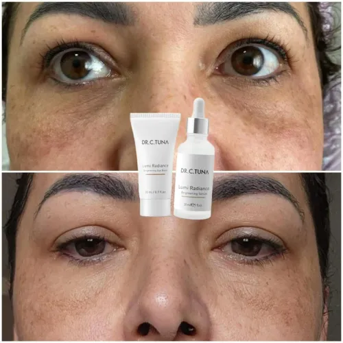 Produtos para tratamento de pele, calcanhar rachados, manchas escuras, melasma etc...