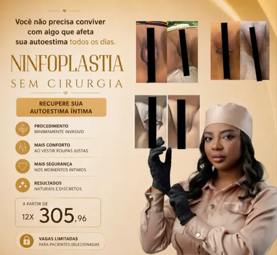 Ninfoplastia sem corte