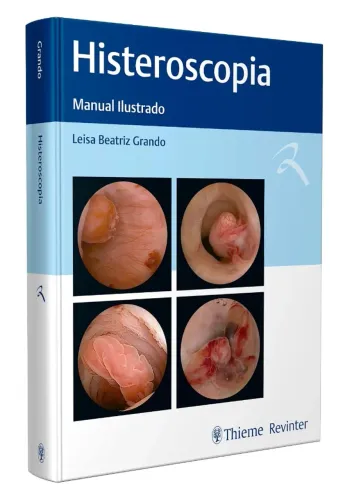 Histeroscopia: Manual Ilustrado - Leisa Beatriz Grando - Novo e Lacrado