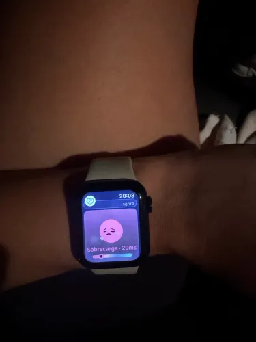 Appple Watch
