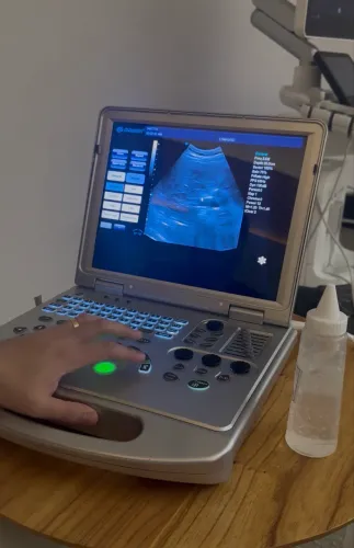 Ultrassom Portátil Color Doppler Dawei DW-C60 Plus
