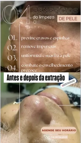 Limpeza de pele