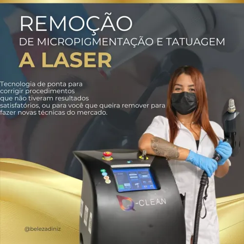 Remoção de micropigmentação e tatuagem e outros procedimentos na área da beleza .