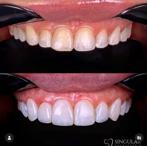 UM SORRISO SAUDÁVEL, BONITO E CUIDADO EM CADA DETALHE.