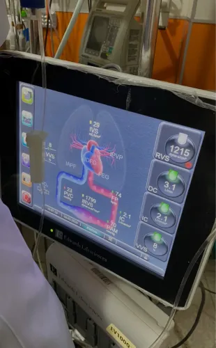 Monitor Edwards Lifesciences EV1000 - Equipamento Hospitalar