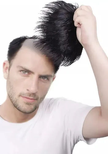 Prótese Capilar Masculina Nova