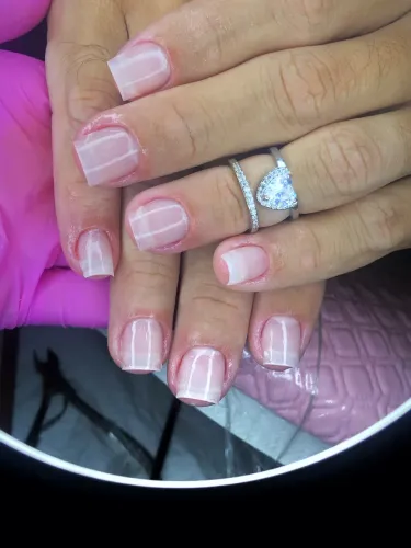 ALOGAMENTO EM GEL