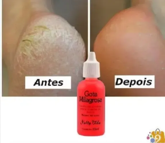 Loção  gota milagrosa para os pés bio instinto 