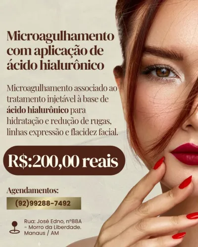 ESTÉTICA FACIAL - MICROAGULHAMENT0