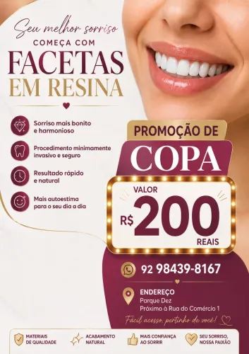 Facetas em resina - superior