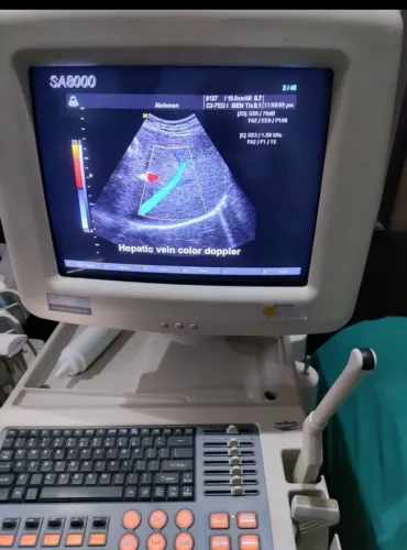 Ultrassonografia Medison SA8000