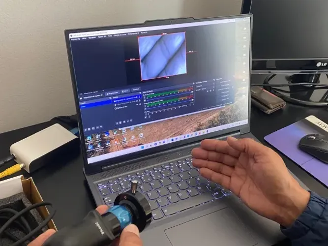 CÂMERA ENDOSCÓPICA USB PORTÁTIL da ESC MEDICAMS