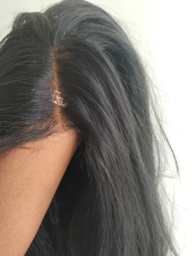Lace wig