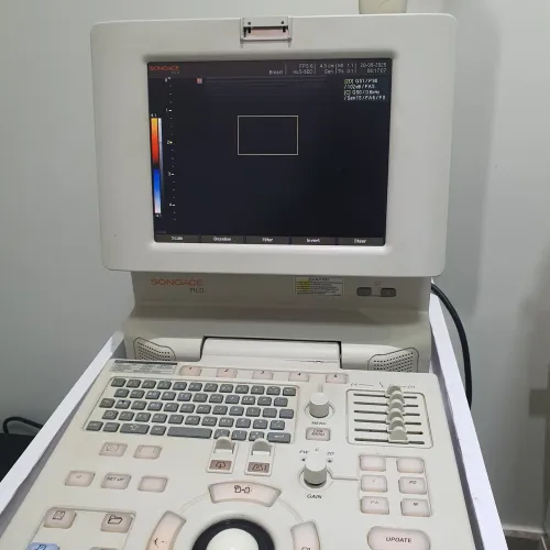Equipamento de ultrassom portátil Samsung sonoece Pico